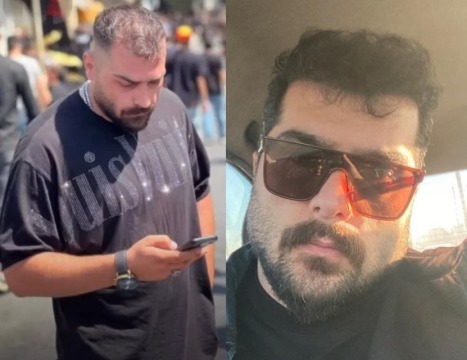 قبل و بعد زیباجویان